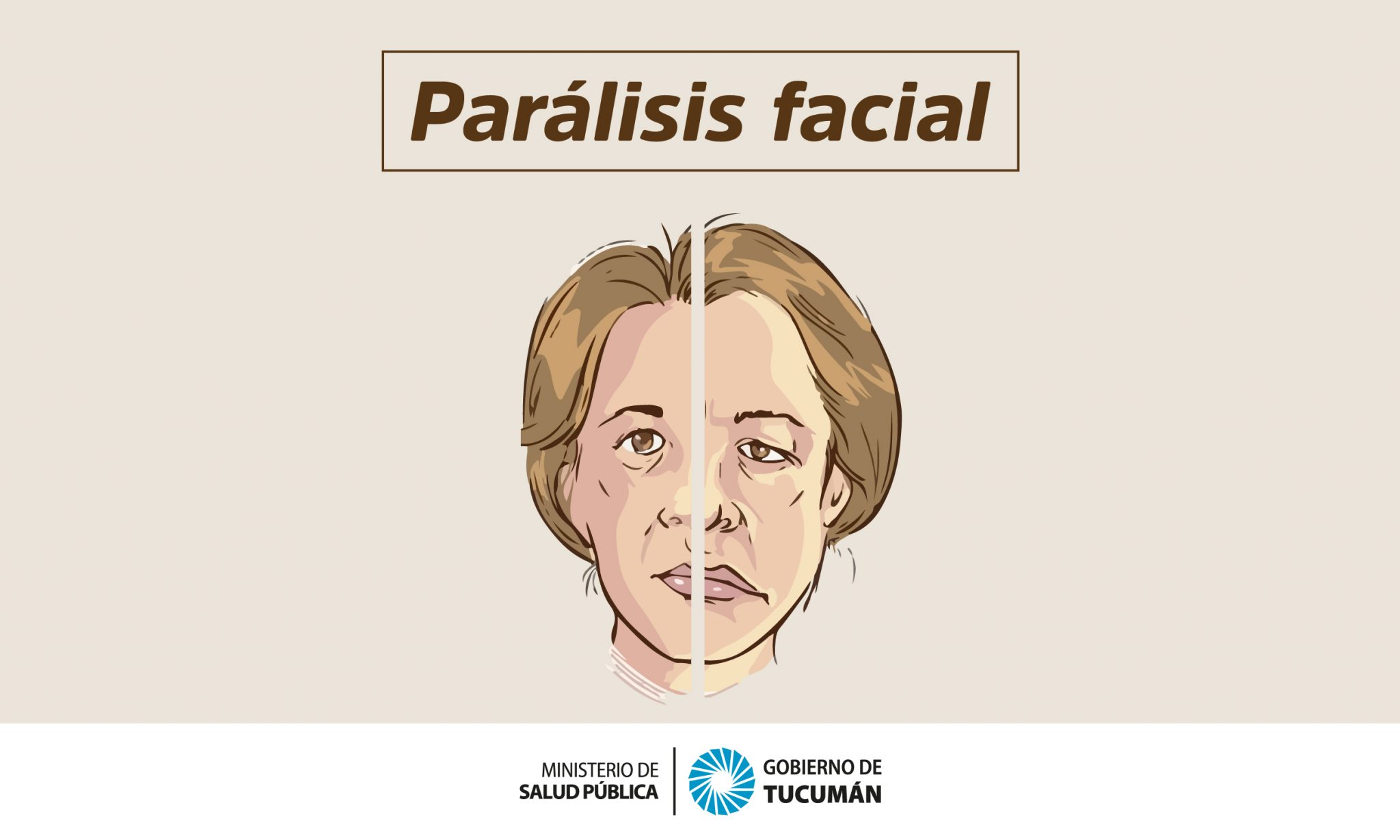 Parálisis Facial Cuáles son sus tipos y cómo deben tratarse Ministerio de Salud Pública de