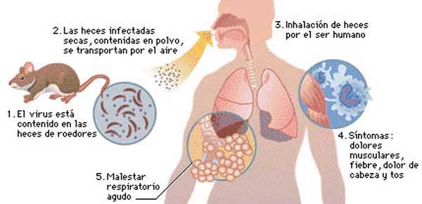hantavirus