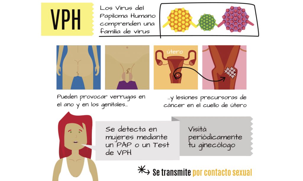 virus del papiloma tratamiento mujeres)