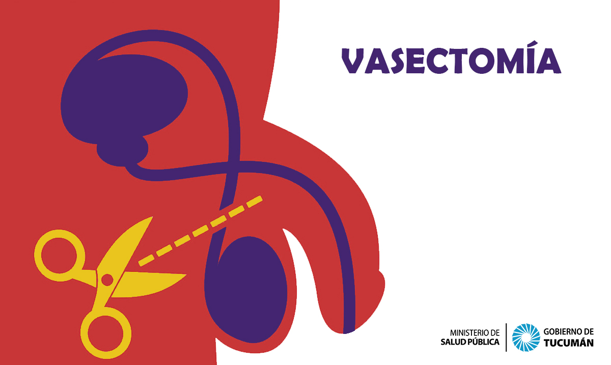 Vasectomía Qué Es Importante Saber Ministerio De Salud Pública De Tucumán 3352