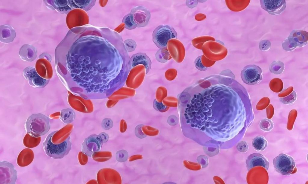 Leucemia: Una enfermedad que puede afectar a cualquier grupo etario