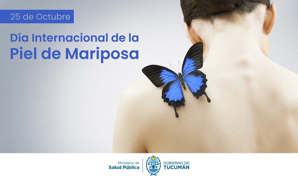 Día Internacional de la Piel de Mariposa Día Internacional de la Piel de Mariposa
