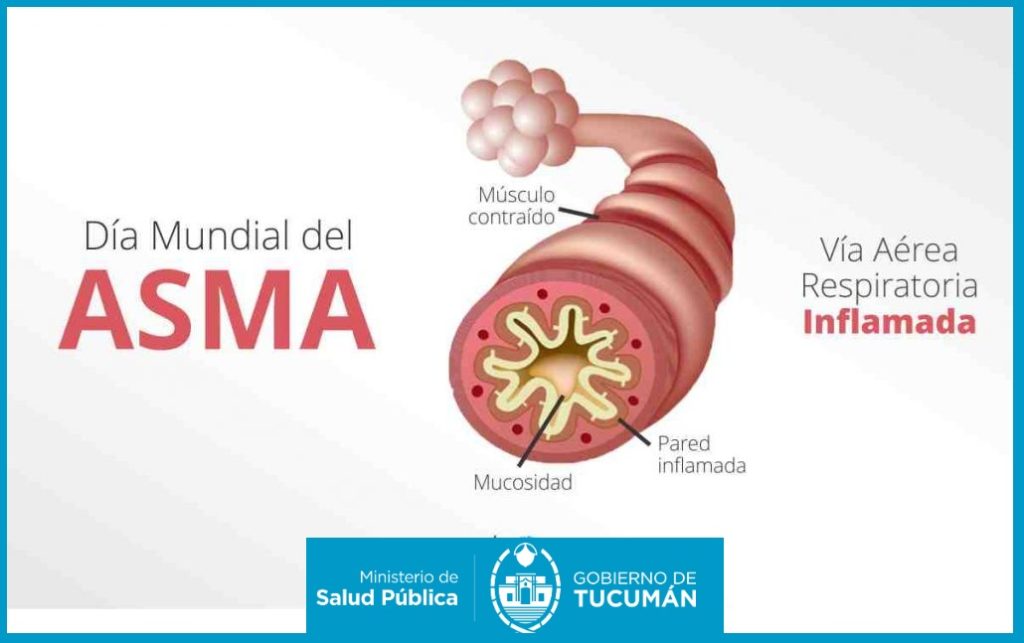Tucumán fortalece la prevención del asma con acciones integrales en toda la provincia