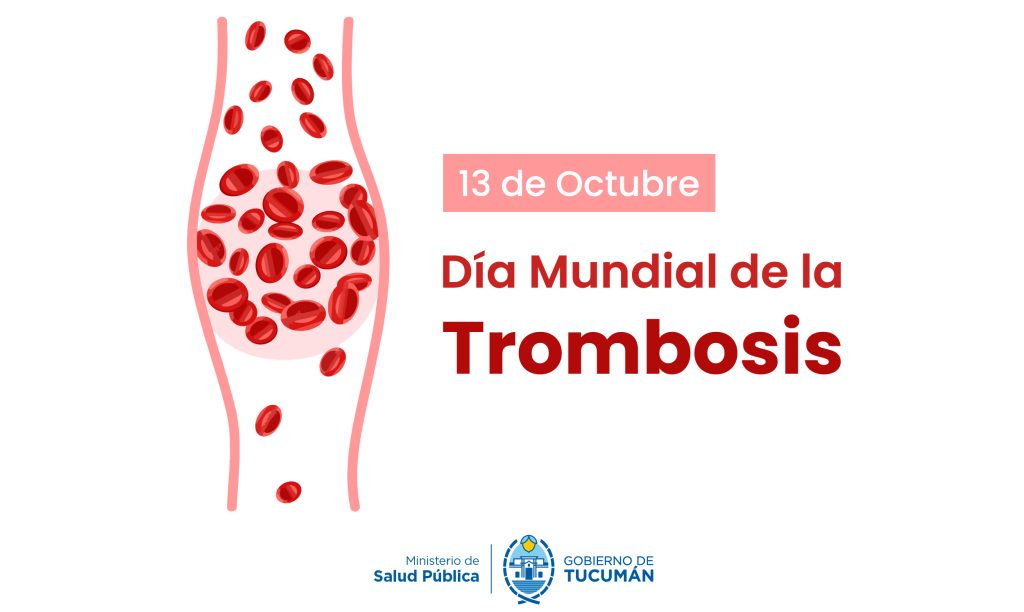Día Mundial de la Trombosis: la prevención y la rehabilitación, claves para cuidar la salud