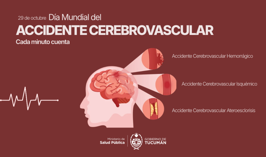 Día Mundial del ACV: la prevención y la atención inmediata son claves para salvar vidas