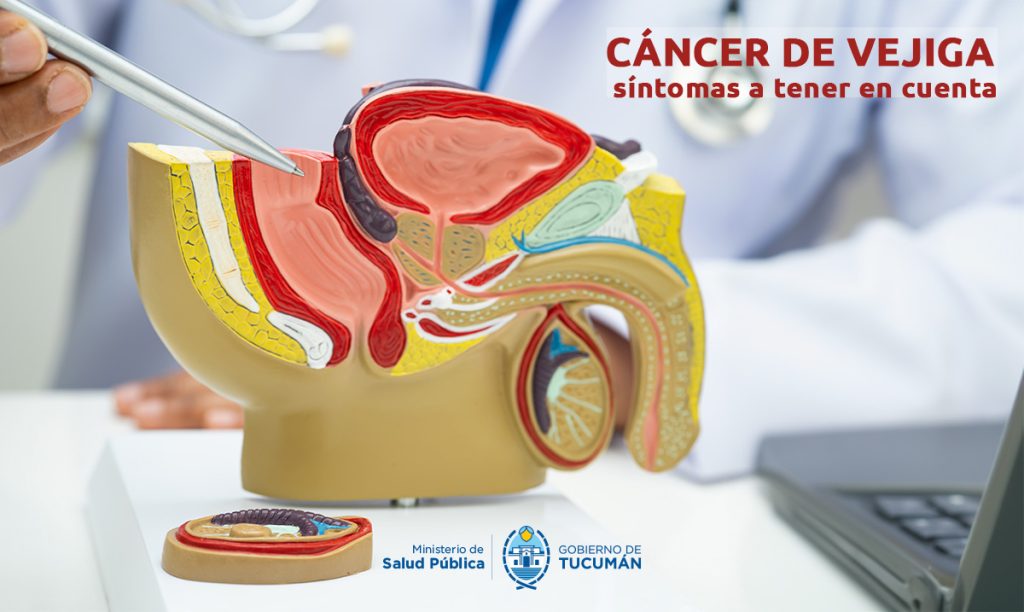 El Hospital Centro de Salud advierte sobre los signos de alerta del cáncer de vejiga