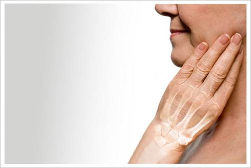 mujer-osteo-2_500x335